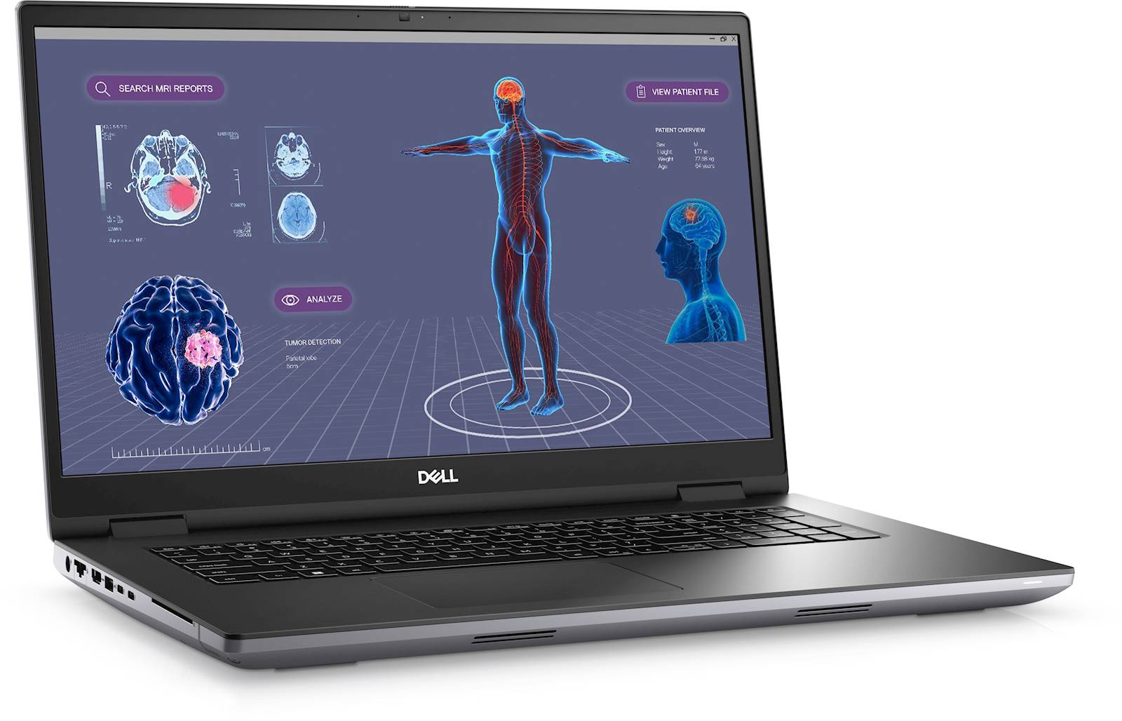 Dell precision 7780 i7-13850hx | 32gb | 1tb ssd | 43,9cm (17,3") | uhd | rtx a2000 8gb | w11pro | profesionalni prenosnik 1 Prenosnik dell precision 7780 i7-13850hx/32gb/1tb ssd/17. 3″ uhd/rtx a2000 8gb/w11pro komponentko